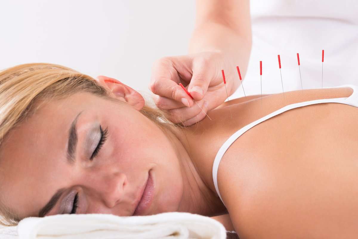 Akupunktur - Bütünsel Sağlık Kliniği